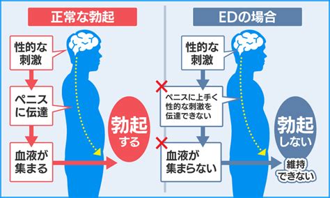 勃起 しにくい|勃起不全（ED）の原因とは？治療や予防方法についても解説！